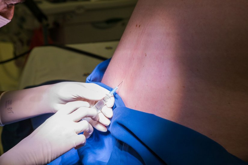 Επισκληρίδιος αναισθησία Επισκληρίδιος αναισθησία