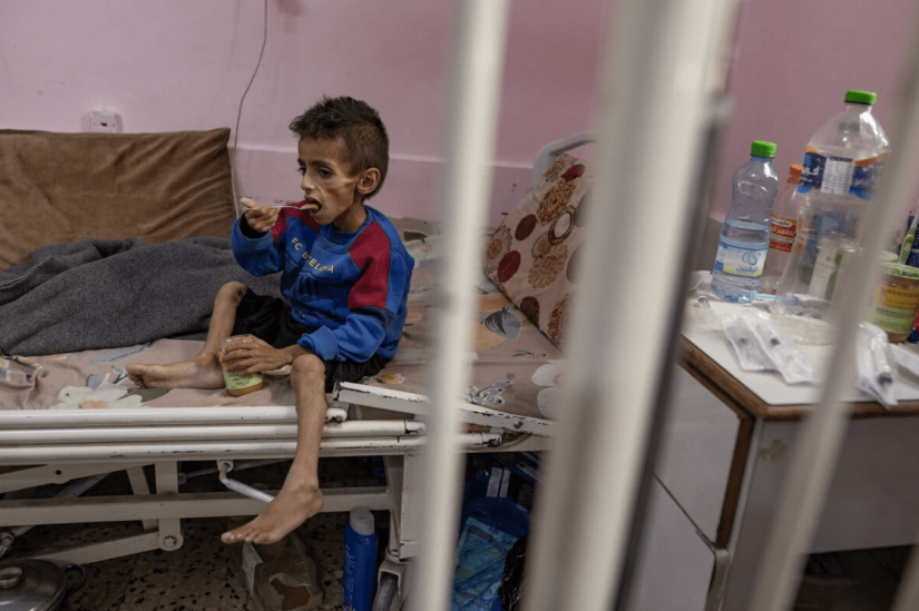 Η λιμοκτονία στη Γάζα δεν είναι ατύχημα Η λιμοκτονία στη Γάζα δεν είναι ατύχημα