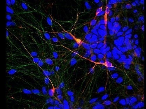 Ανακάλυψαν ουσία με την οποία πέτυχαν να θεραπεύσουν σε σημαντικό βαθμό ποντίκια που έπασχαν από το αντίστοιχο της νόσου