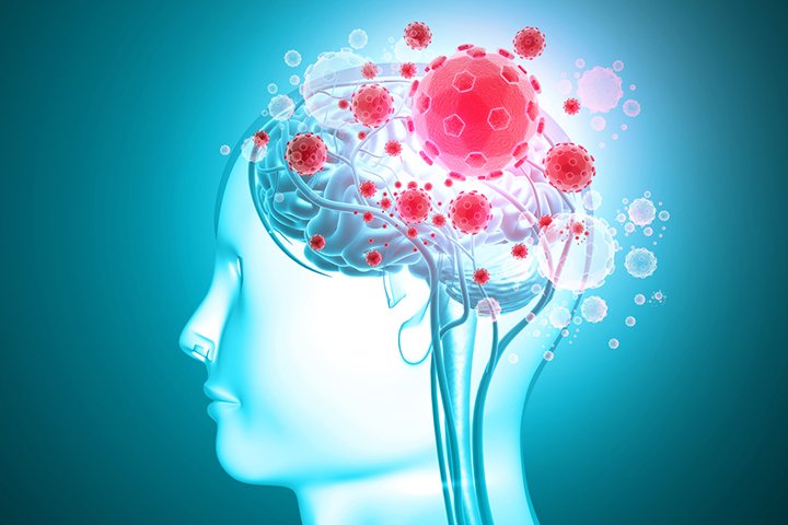 covid_19_and_brain covid_19_and_brain