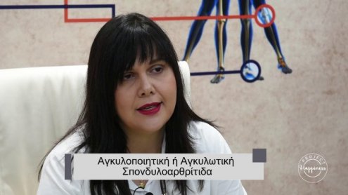 Project Happiness: Αγκυλωτική σπονδυλοαρθρίτιδα από την Όλγα Λουκαδάκη Project Happiness: Αγκυλωτική σπονδυλοαρθρίτιδα από την Όλγα Λουκαδάκη