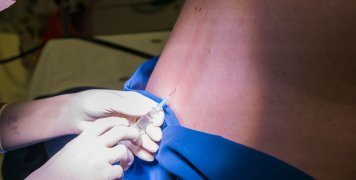 Επισκληρίδιος αναισθησία