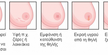 Αν διαπιστώσεις κάτι από τα παρακάτω συμβουλέψου το γιατρό σου