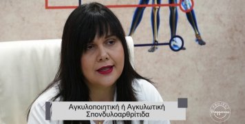 Project Happiness: Αγκυλωτική σπονδυλοαρθρίτιδα από την Όλγα Λουκαδάκη