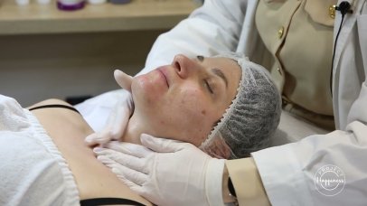 Project Happiness: Μεσοθεραπεία με dermapen από την Ελένη Ποδαρά Project Happiness: Μεσοθεραπεία με dermapen από την Ελένη Ποδαρά